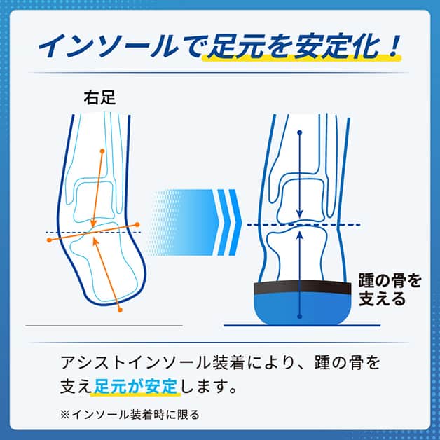 インソールで足元を安定化！